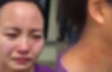 Seorang perawat di China yang diserang oleh pasien.