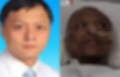 Menderita Covid-19, Seorang Pasien di China Alami Gejala Aneh Kulitnya Berubah Menjadi Hitam Pekat, Dokter Ungkap Penyebabnya