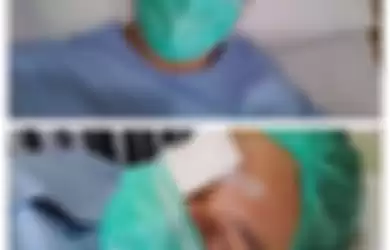 Baim operasi katarak