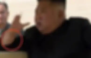 20 Hari Menghilang dari Publik, Tanda di Pergelangan Tangan Kim Jong Un Akhirnya Ungkap ke Mana Saja Sang Diktator Selama Ini