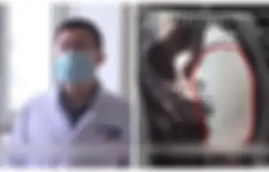 Orang Tua Panik Mengetahui Anak Gadisnya yang Baru Berusia 15 Tahun Hamil Perutnya Terus Membesar, Setelah Periksa ke Dokter, Orang Tua Makin Syok