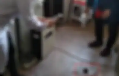 Lima Tahun Setelah Melakukan Operasi Rahim, Organ Kemaluan Wanita Ini Sering Merasa Kesakitan, Ternyata Selama Ini Ada Benda Ini di Organ Intimnya