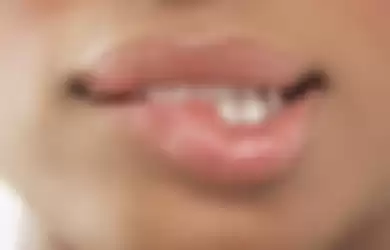 Kebiasaan gigit bibir saat gugup, bisa bikin masalah dikemudian hari. 