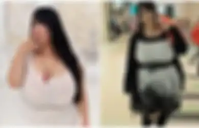 Punya Payudara Terlalu Besar Hingga 120 Cm, Wanita Jepang Ini Justru Merasa Tersiksa Kerap Rasakan Sakit Pada Bagian Ini 