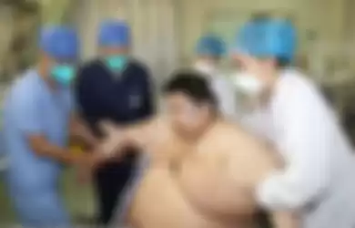 Zhou pria asal Wuhan yang ngalamin kenaikan berat badan selama pandemi, kini ia ditangani rumah sakit untuk di operasi penurunan berat badan