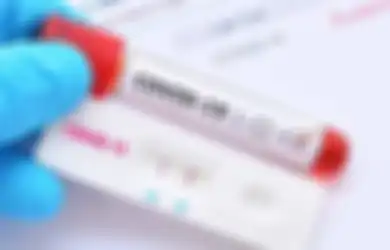 Dokter Spesialis Paru Berikan Opsi Deteksi Kilat Covid-19 Lewat Tes Swab Antigen, Dijamin Lebih Akurat Dibanding Rapid Test