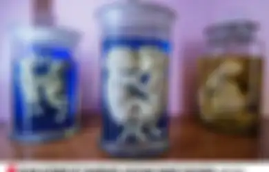 Ada Janin Bayi, Potongan Organ Hingga Mayat Manusia, Inilah Barang-barang Mengerikan yang Dijual di Pasar Gelap Harganya Ada yang  Mencapai Rp1,7 Miliar