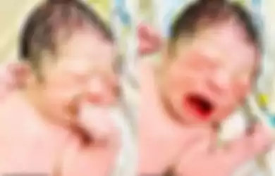 Bayi hasil kebobolan lahir bersama alat kontrasepsi yang dipasang ibunya.