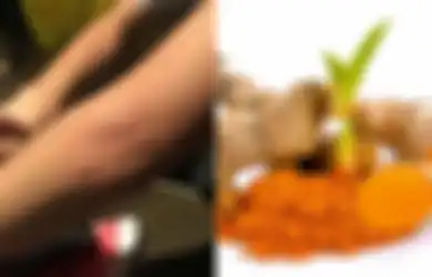Obat Biduran Rumahan yang Mudah Didapat Bahkan Ada di Dapur Kita
