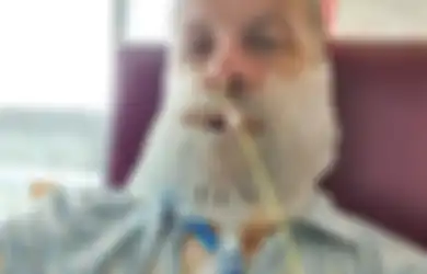 27 Tahun Bandel 'Mogok' Periksakan Giginya, Pria Ini Berujung Tak Bisa Bicara bahkan Makan, Hal Mengerikan Ini yang Harus Dokter Lakukan  pada Rahangnya Demi Selamatkan Nyawa