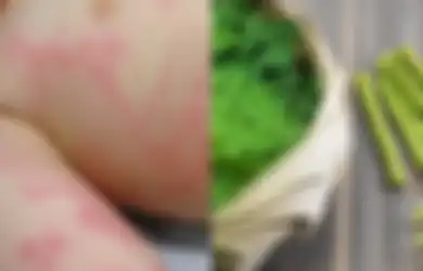 Coba Obati Biduran dengan Antihistamin Alami Termasuk Daun Kelor