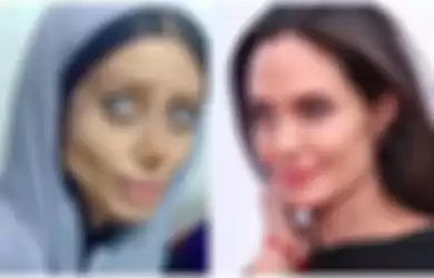 3 Tahun Lalu Ngaku Oplas 50 Kali Demi Mirip Angelina Jolie, Gadis Ini Menyesal Seumur Hidup Usai Dipenjara 10 Tahun Gegara Unggah Foto-fotonya yang Mirip Zombie, Kini Hidup Menderita di Penjara Paling Suram di Iran