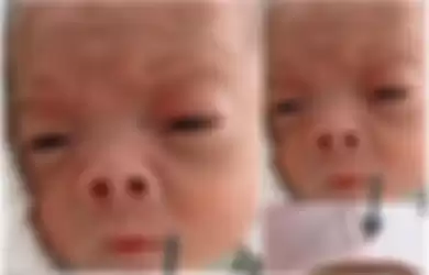Nyaris Ditelantarkan karena Wajahnya Bak 'Itik Buruk Rupa', Penampilan Bayi Ini Berubah jadi 'Angsa' Rupawan, Bikin Siapa pun Gemas