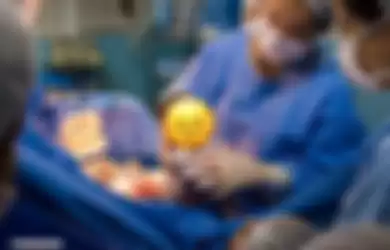 Foto bayi yang baru lahir dari proses operasi sesar tunjukkan