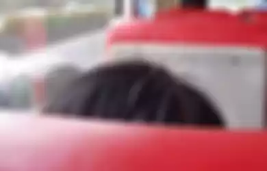 Foto Kepala Wanita Ditusuk Sembilan Jarum Saat Naik Bus Viral di Facebook  