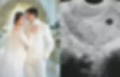 2 Hari Menikah, Felicya Angelista Sudah Posting USG Kandungan Buat Aurelie dan Audy Marisa Kaget: Semoga Lancar Sesuai Harapan