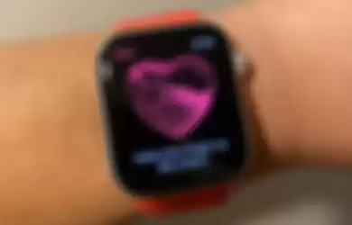 ECG di watchOS 7.3