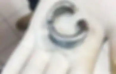 Ingin Buat Pacar Terkesan Saat Hari Valentine, Pria Ini Pasang Cincin Baja di Alat Kelaminnya, Begini Akhir yang Tak Disangka-sangkanya