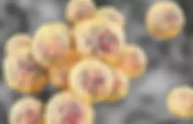 Staphylococcus aureus, bakteri yang resisten terhadap antibiotik Methicillin   