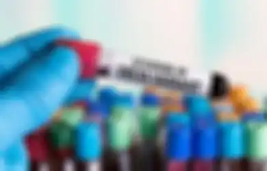 Disebut Sebagai Varian Covid-19 Paling Berbahaya Saat Ini, di Kanada Virus Corona Varian Delta Malah Tidak Terdeteksi Bahkan Ilmuwan Kesulitan Menemukannya, Apa Maksudnya?