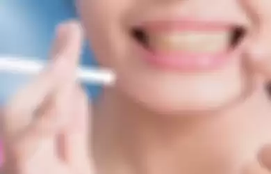 Cara mengatasi gigi kuning 