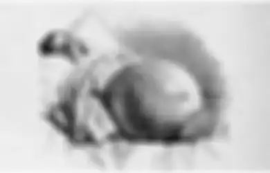 Mengira Hamil Anak Kembar, Wanita Ini Ternyata 'Mengandung Penyakit' Seberat 10 Kg, Nekat Berkuda Sejauh 96 Kilometer untuk Jalani Operasi Kista Pertama di Dunia pada 1809