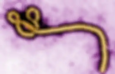 Afrika Barat Dilanda Kemalangan Bertubi-tubi, Covid-19 Belum Tuntas, Wabah Baru Virus Marburg dan Ebola Muncul Menambah Derita