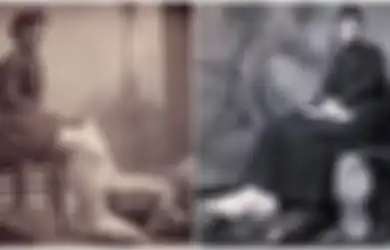 Kehidupan Tragis Fanny Mills si Gadis Berkaki Raksasa, Saking Teramat Besar Kakinya Hanya Menggunakan Kaus Kaki dari Sarung Bantal