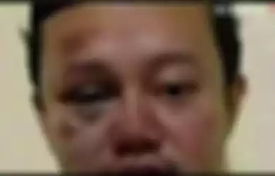 viral foto Herry Wirawan, pemerkosa 12 santriwati lebam-lebam pasca masuk penjara 