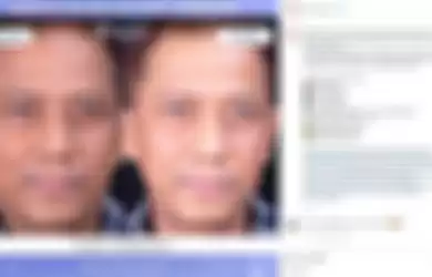 Begini wajah Doddy Sudrajat setelah perawatan Rp 80 juta