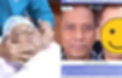Ogah kalah glowing seperti Mayang, begini wajah Doddy Sudrajat setelah perawatan Rp 80 juta.