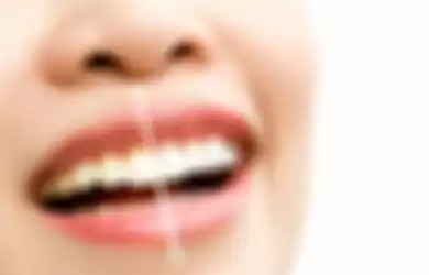 Ramuan alami yang bikin gigi putih cemerlang.