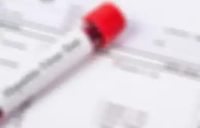 Baru Saja Istirahat dari Pandemi Covid-19 Dunia Harus Hadapi Bahaya Baru, Seberapa Bahayanya Hepatitis Akut Misterius yang Sudah Menginfeksi Banyak Anak Kecil di Dunia?