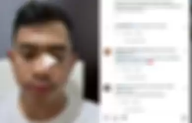 YouTuber Tanboy kun minta maaf ke Irfan Hakim usai one chip challenge