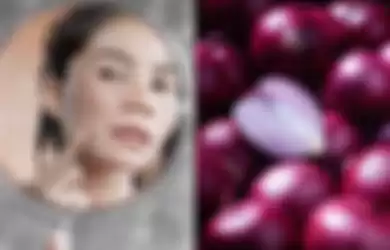 Anda bisa menggunakan bawang merah yang seperti ini untuk menghilangkan flek hitam dalam 10 menit