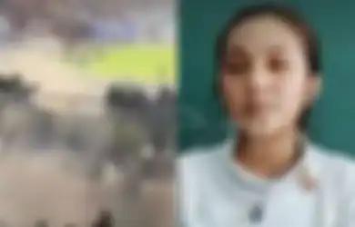 Pusing Luar Biasa Usai Gas Air Mata Ditembakkan, Kini Masih Rasakan Dampaknya, Begini Kesaksian Aremanita Korban Tragedi Kanjuruhan