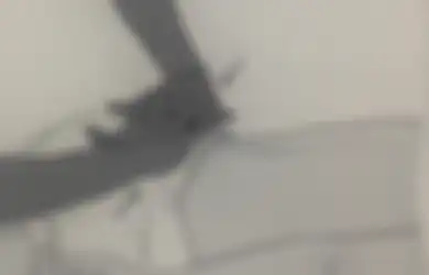 Cukup Praktikkan Langkah Ini, Begini Cara Pijat Atasi Nyeri Saat Haid