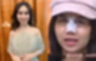 Mayang adik Vanessa Angel melakukan operasi hidung.