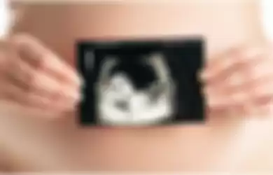 USG kehamilan