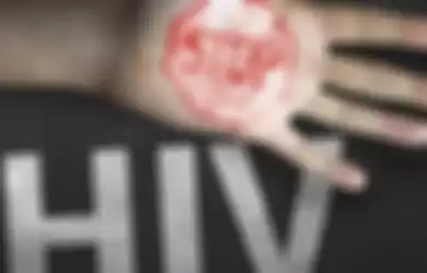 HIV AIDS ditanggung BPJS Kesehatan