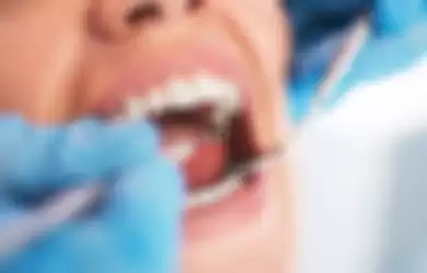 Pelayanan Pemeriksaan Gigi yang Ditanggung BPJS Kesehatan