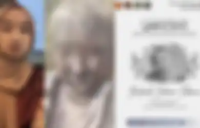 Innalillahi, Zhafirah Zahrim, Mahasiswi Yang Tubuhnya Penuh Abu Letusan Gunung Marapi Kini Meninggal Dunia