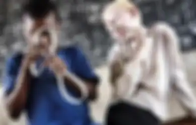 Di Malawi, Orang Albino Diburu, Dibantai, dan Diambil Organnya untuk Ilmu Sihir