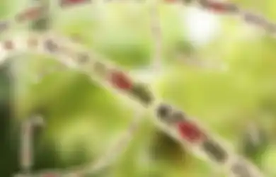 Ditemukan Bakteri Baru yang Menyebabkan Penyakit Mirip Sapi Gila di Afrika (1)