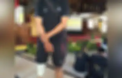 Kehilangan Kaki, Agus Arnawa Tetap Berlari