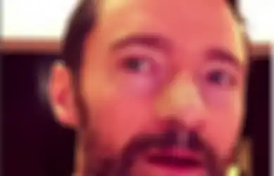 Kena Kanker Kulit, Hugh Jackman Membuat Peringatan dengan Foto Selfie di Instagram