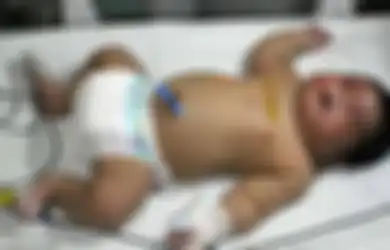 Lahir dengan Berat 6,7 Kg, Bayi Ini Jadi yang Terbesar di India
