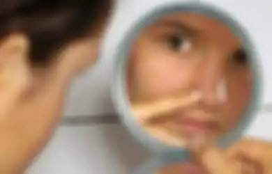 Obat Jerawat yang Ampuh, Adakah?