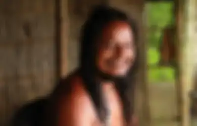 Jika Viona Magdalena Telanjang saat Belanja, Pria Ini Telanjang Bulat Seumur Hidupnya. Alasannya Bikin Kita Bersyukur