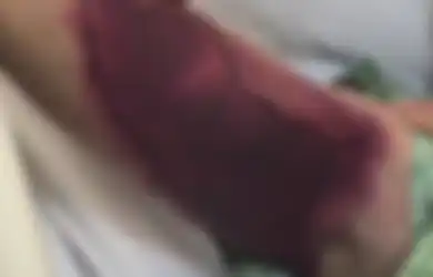 Upaya Pria Ini untuk Ber-selfie dengan Ular Berbisa Berakhir dengan Tagihan Rp2 Miliar